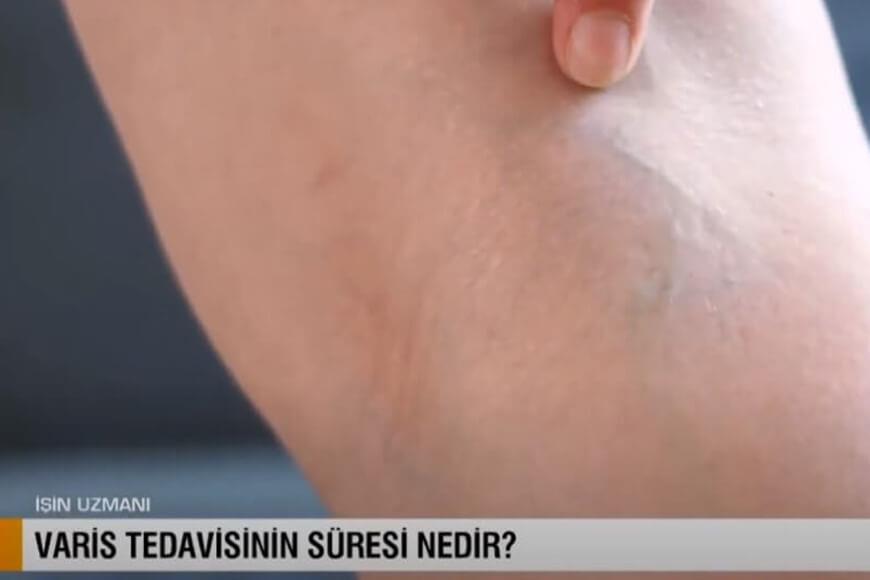 10 Dakikada Varis Tedavisi Olur Mu?