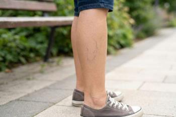 Kılcal Damar Nedir?