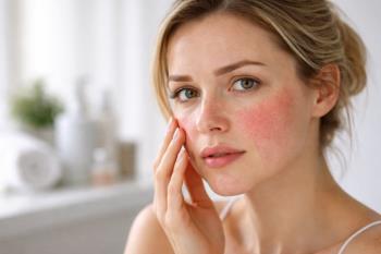 Roza Hastalığı Nedir?