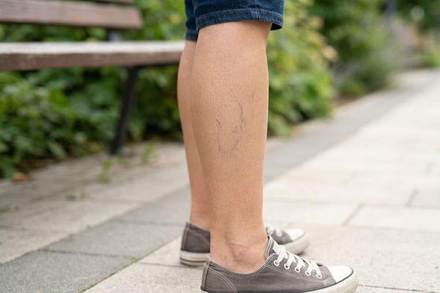 Kılcal Damar Nedir?